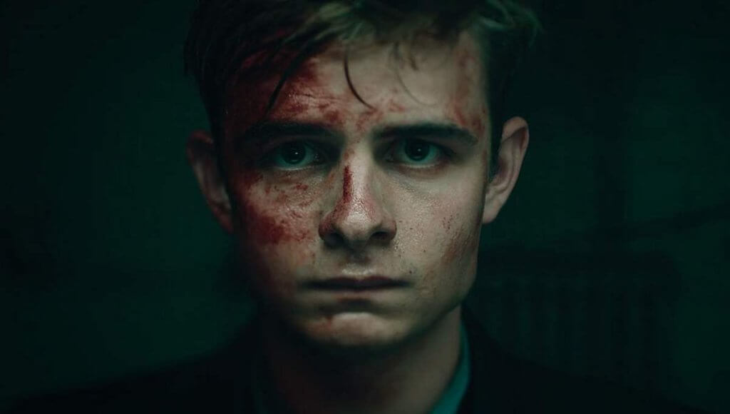 An injured Guy